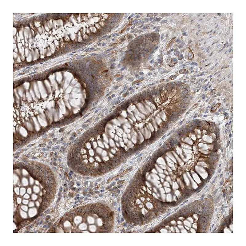 Atlas Antibodies Anti-MYL5 Antibody