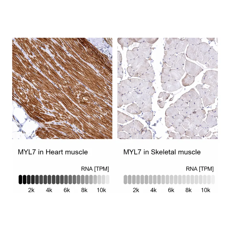 Atlas Antibodies Anti-MYL7 Antibody