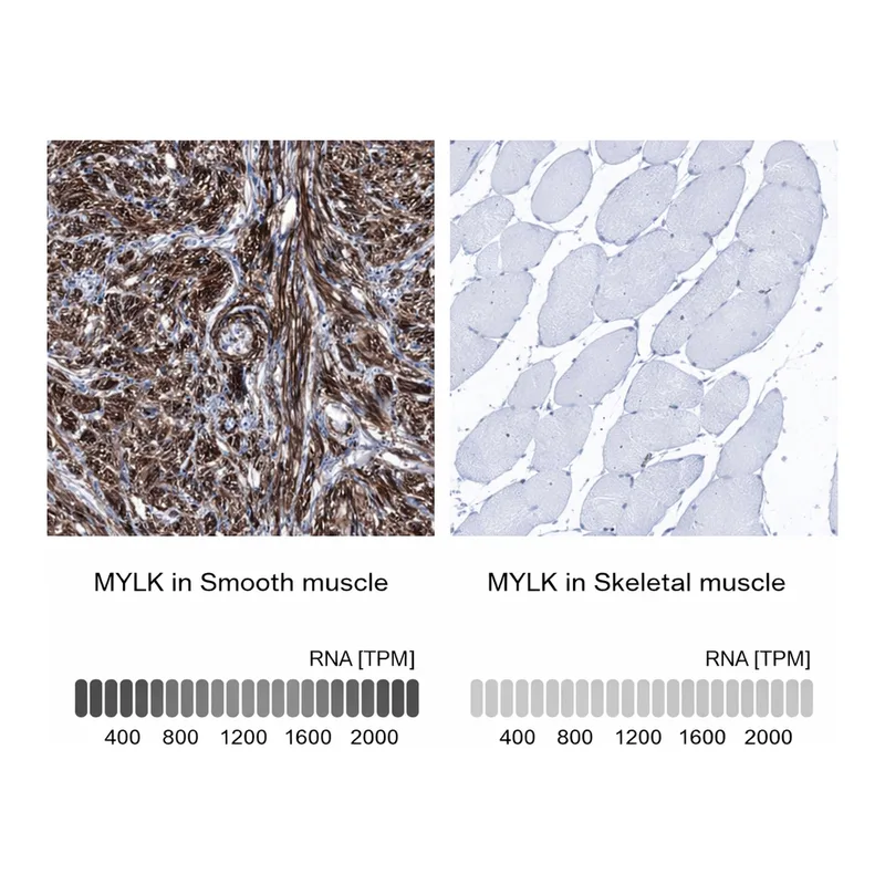 Atlas Antibodies Anti-MYLK Antibody