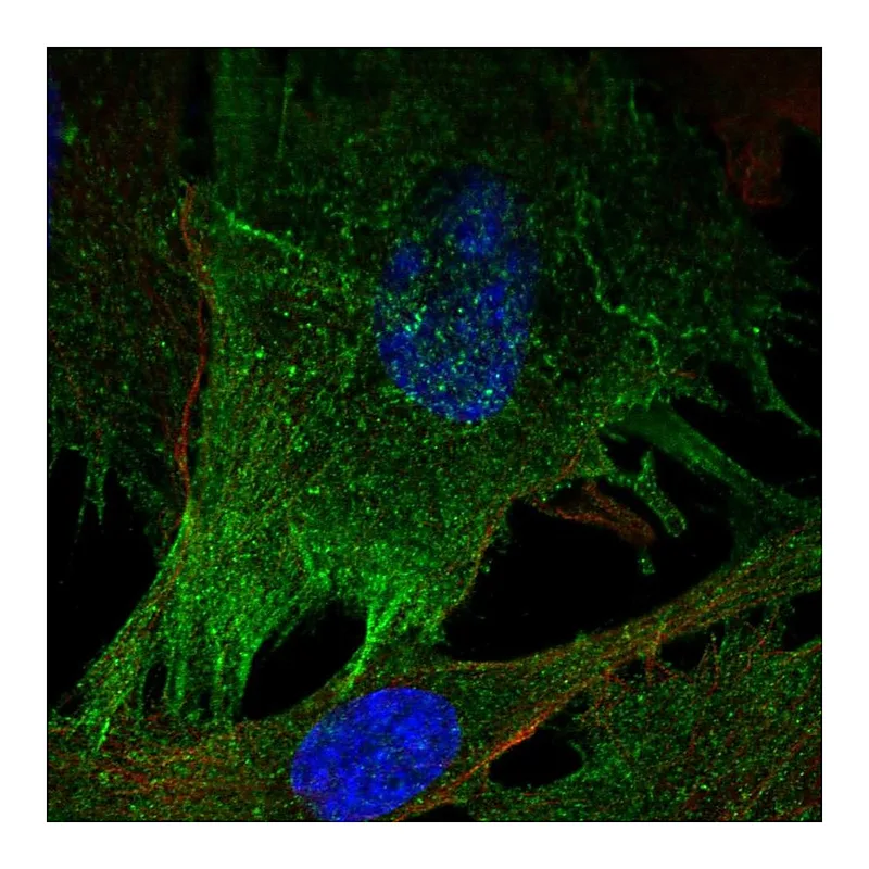 Atlas Antibodies Anti-MYLK Antibody