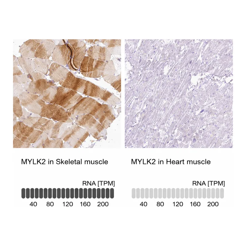 Atlas Antibodies Anti-MYLK2 Antibody