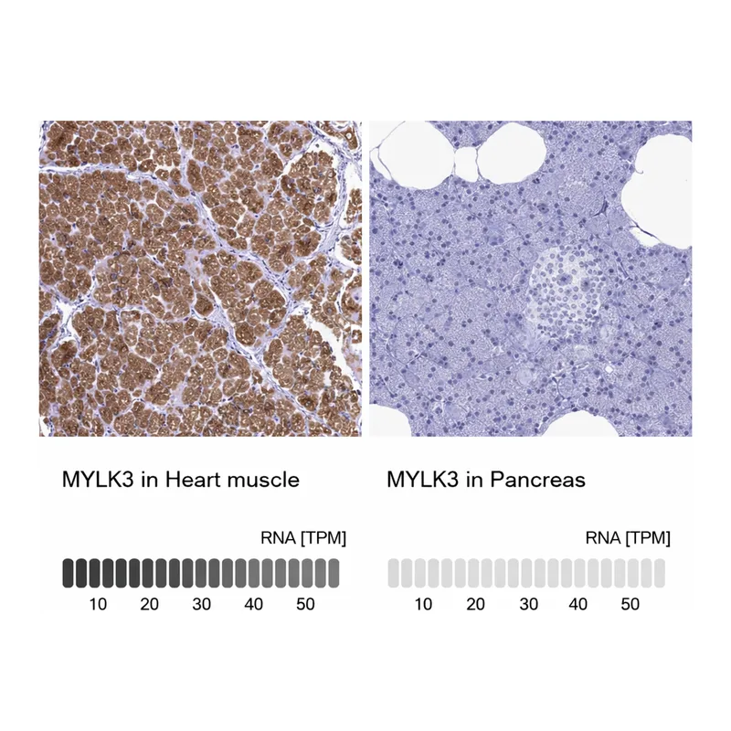 Atlas Antibodies Anti-MYLK3 Antibody