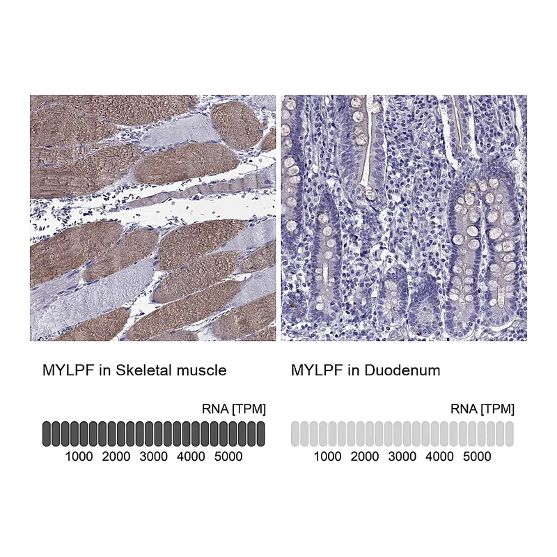 Atlas Antibodies Anti-MYLPF Antibody