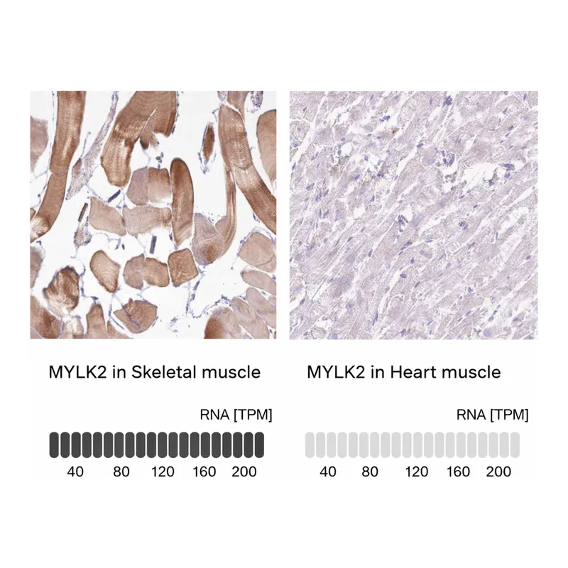 Atlas Antibodies Anti-MYLK2 Antibody