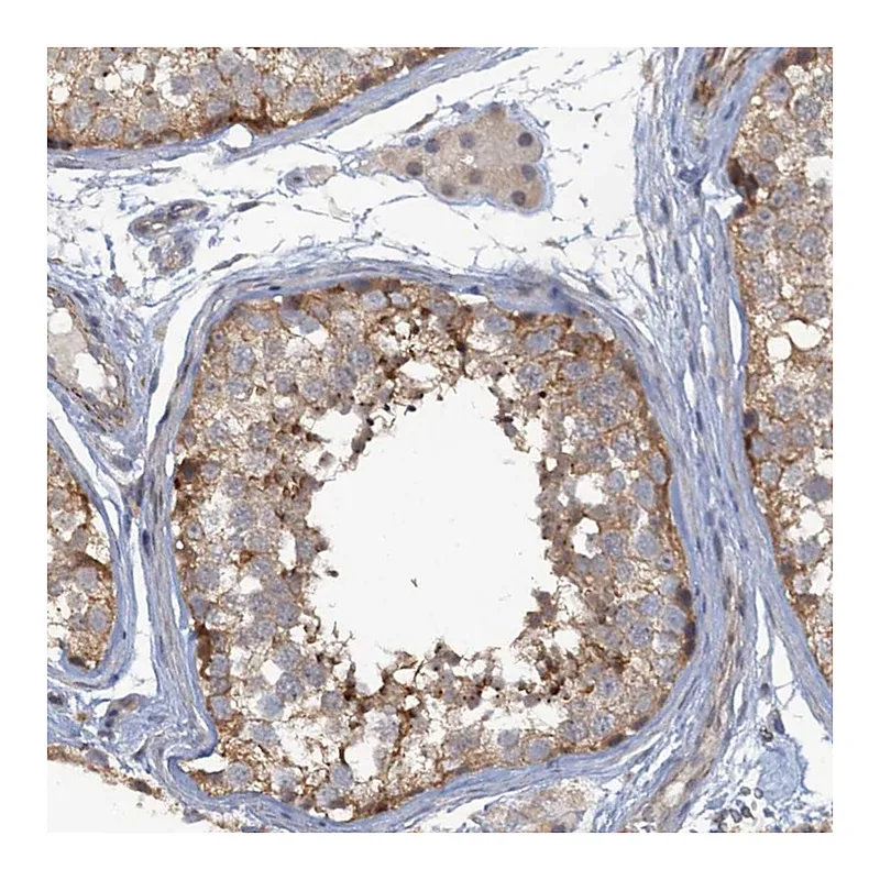Atlas Antibodies Anti-MYO16 Antibody