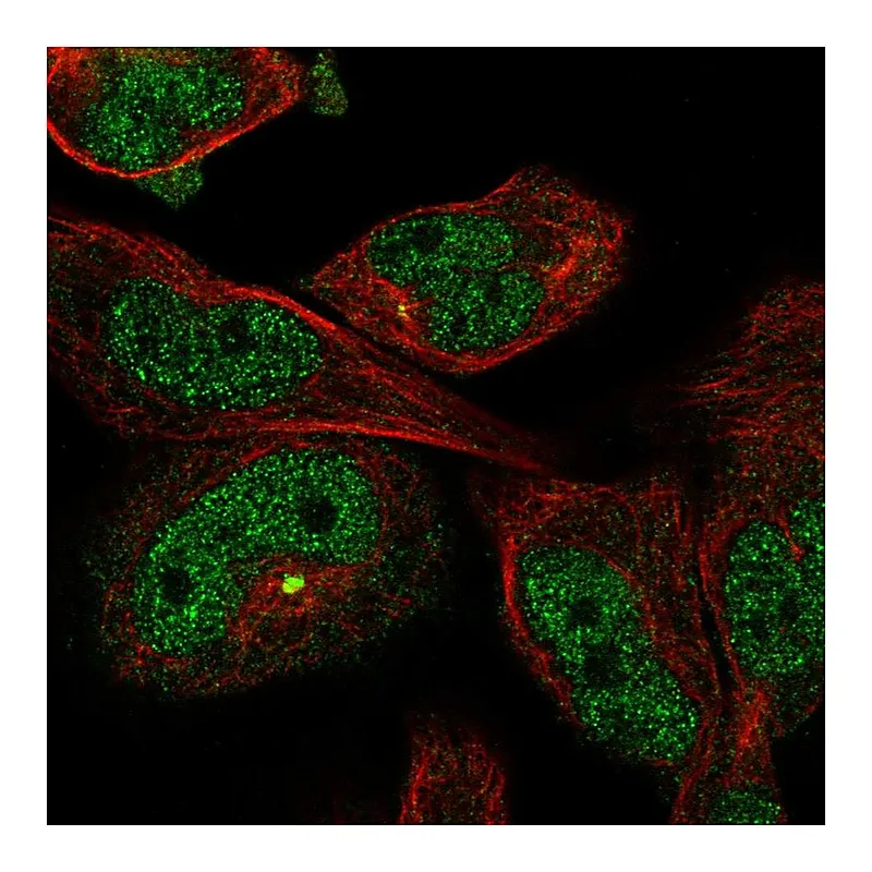 Atlas Antibodies Anti-MYO18B Antibody