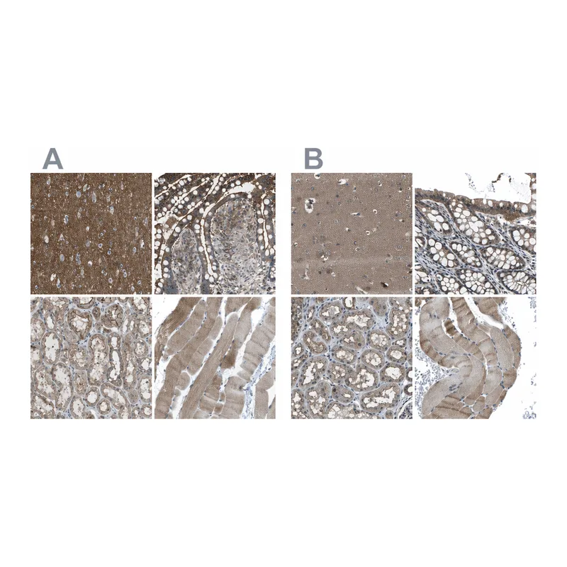 Atlas Antibodies Anti-MYO18A Antibody