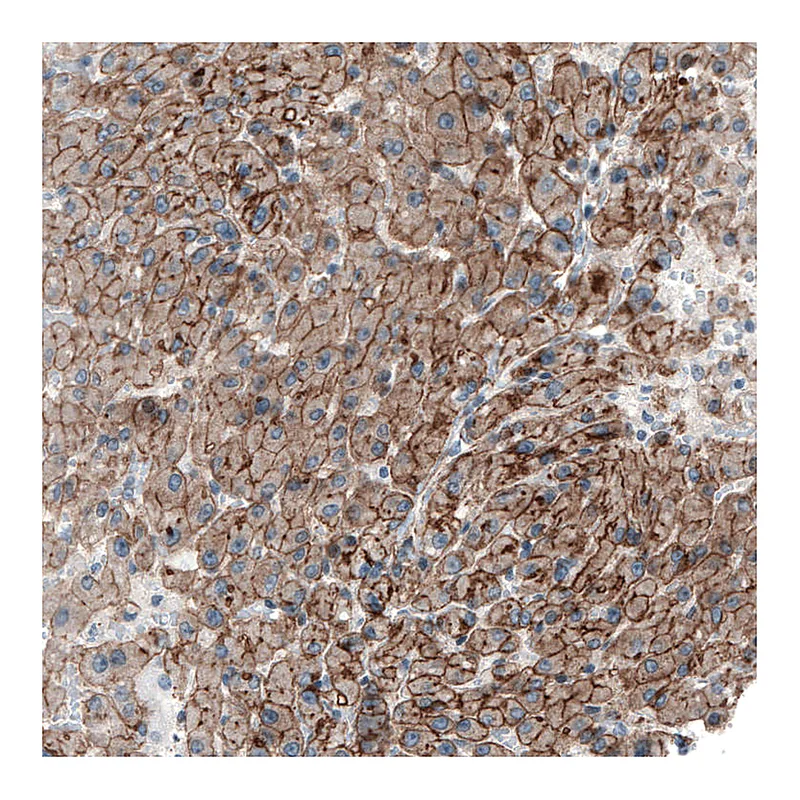 Atlas Antibodies Anti-MYO1B Antibody