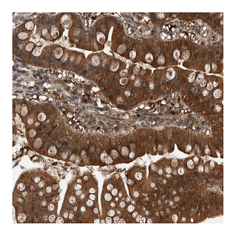 Atlas Antibodies Anti-MYO1E Antibody