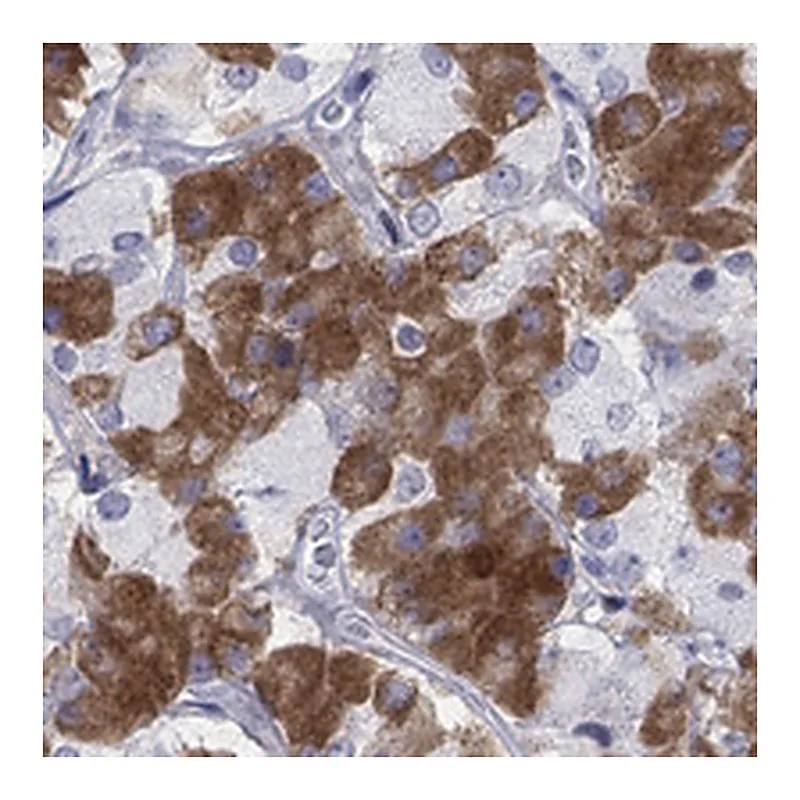 Atlas Antibodies Anti-MYO3A Antibody