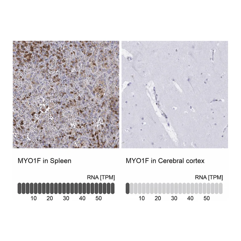 Atlas Antibodies Anti-MYO1F Antibody