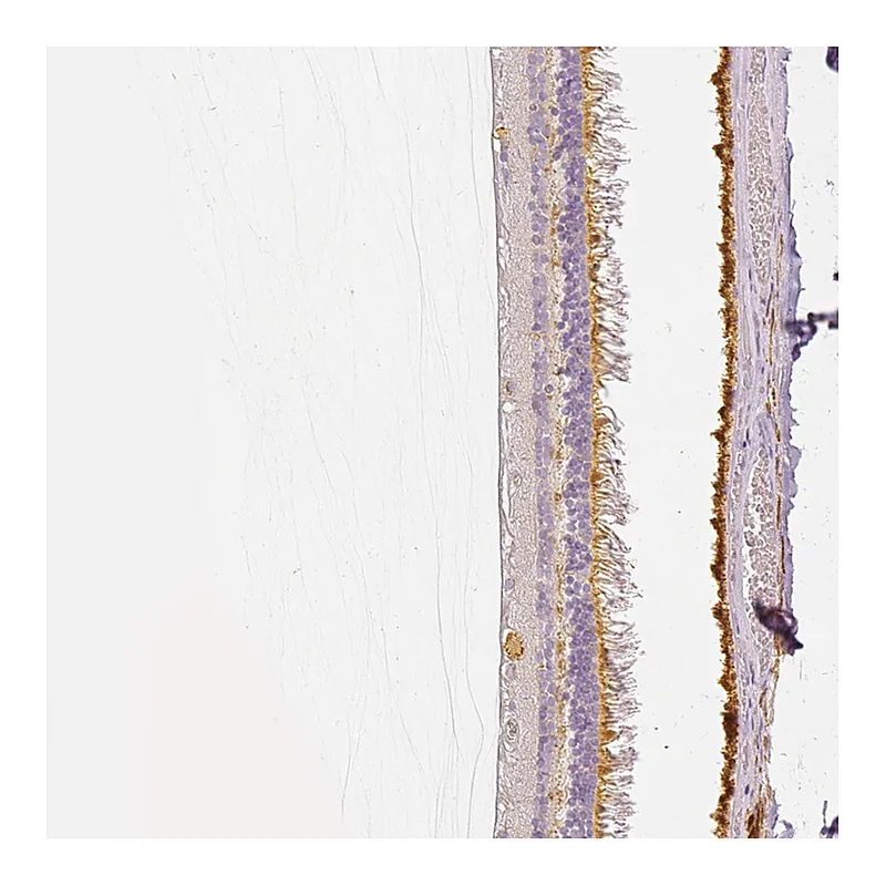 Atlas Antibodies Anti-MYO3A Antibody