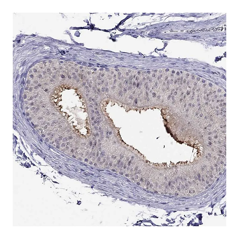 Atlas Antibodies Anti-MYO3B Antibody