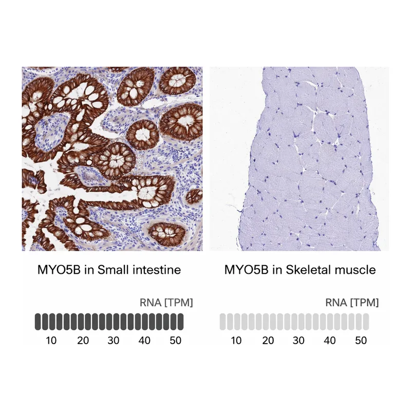 Atlas Antibodies Anti-MYO5B Antibody