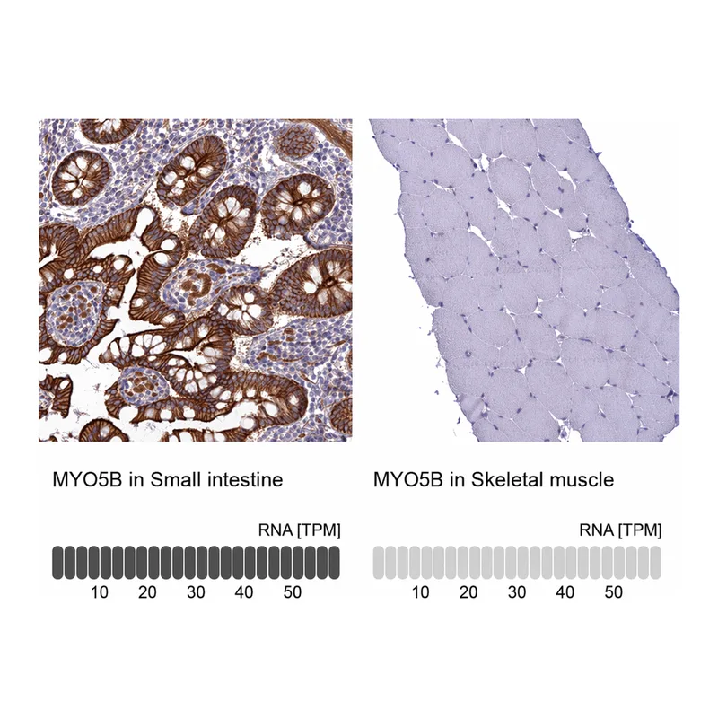Atlas Antibodies Anti-MYO5B Antibody