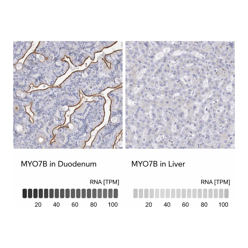 Atlas Antibodies Anti-MYO7B Antibody