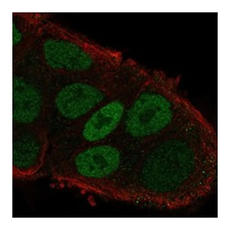Atlas Antibodies Anti-MYO6 Antibody
