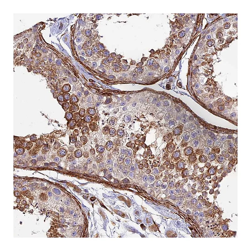 Atlas Antibodies Anti-MYO9A Antibody