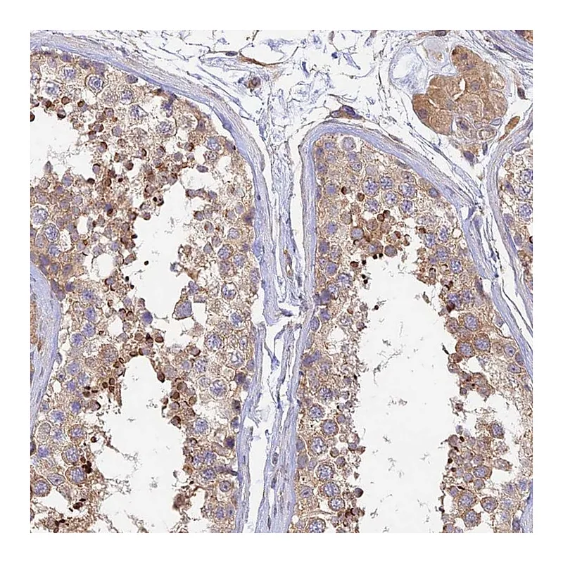 Atlas Antibodies Anti-MYO9A Antibody