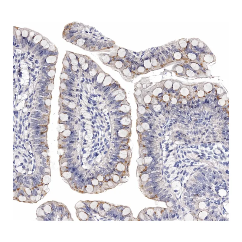 Atlas Antibodies Anti-MYOC Antibody