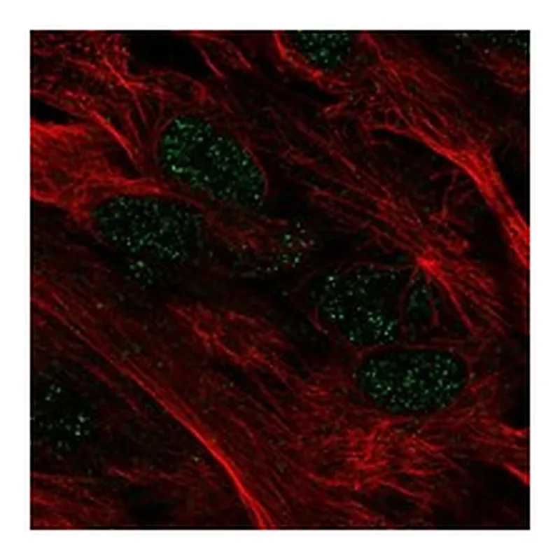 Atlas Antibodies Anti-MYOCD Antibody