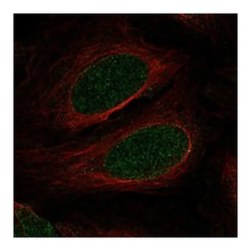 Atlas Antibodies Anti-MYOCD Antibody