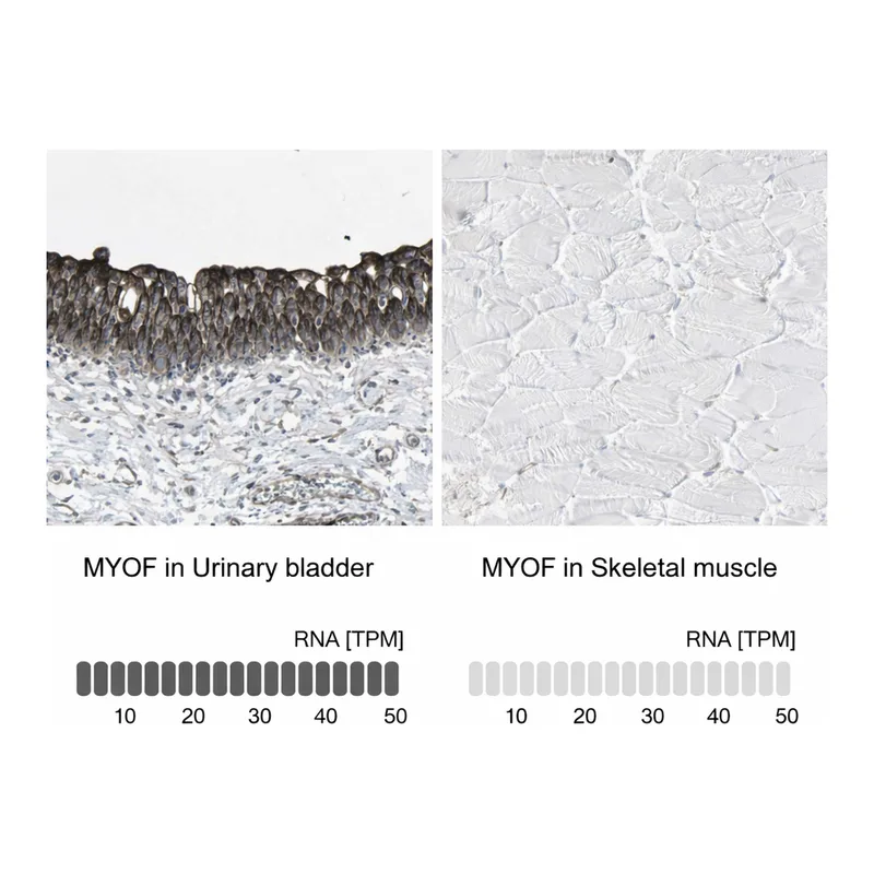 Atlas Antibodies Anti-MYOF Antibody