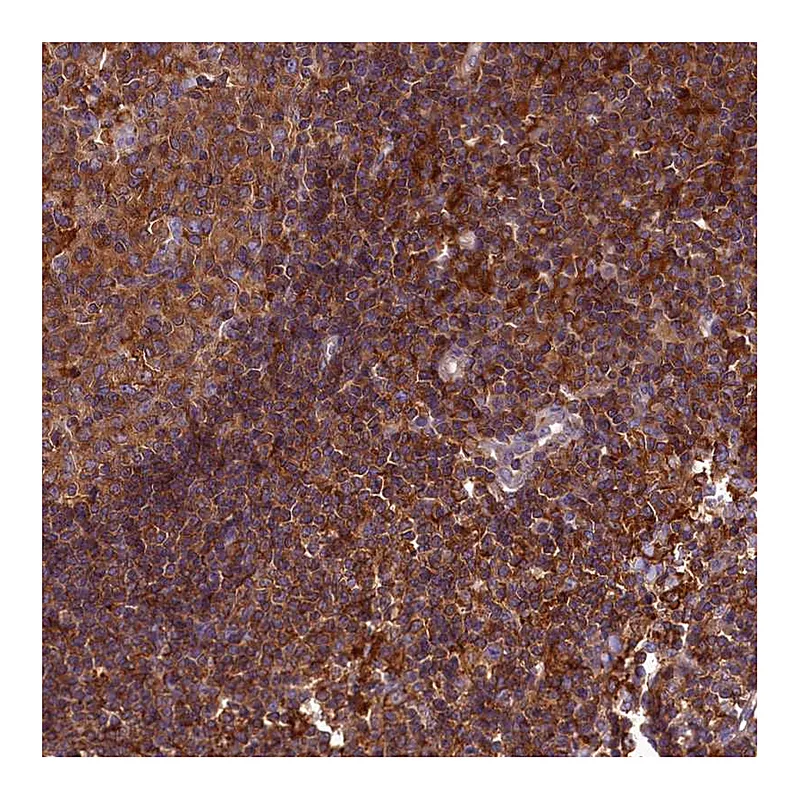 Atlas Antibodies Anti-MYO9B Antibody