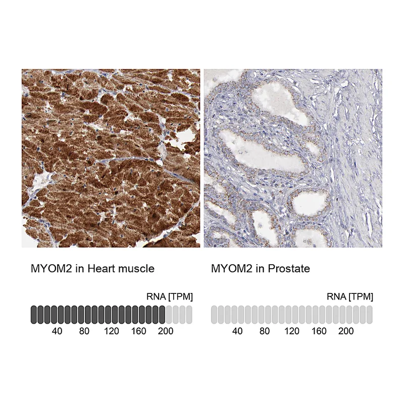 Atlas Antibodies Anti-MYOM2 Antibody