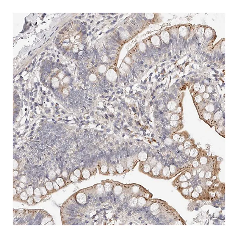 Atlas Antibodies Anti-MYOM3 Antibody