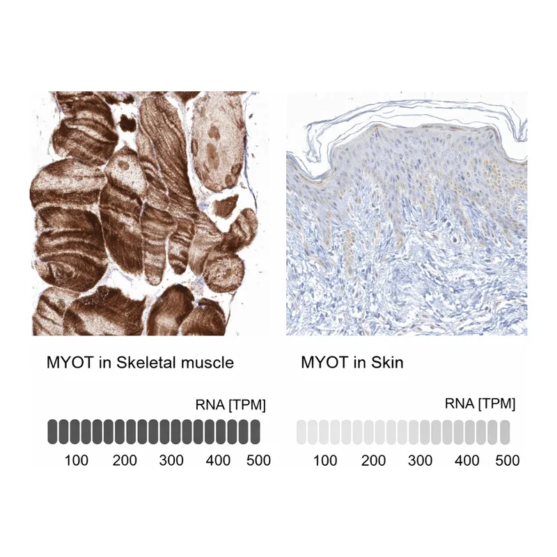 Atlas Antibodies Anti-MYOT Antibody