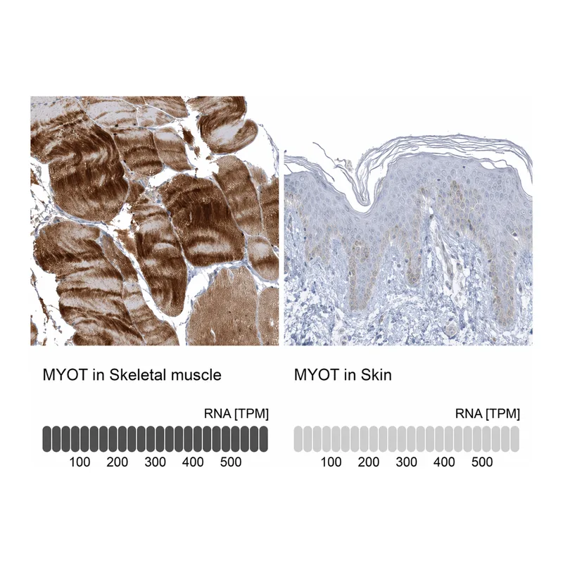 Atlas Antibodies Anti-MYOT Antibody