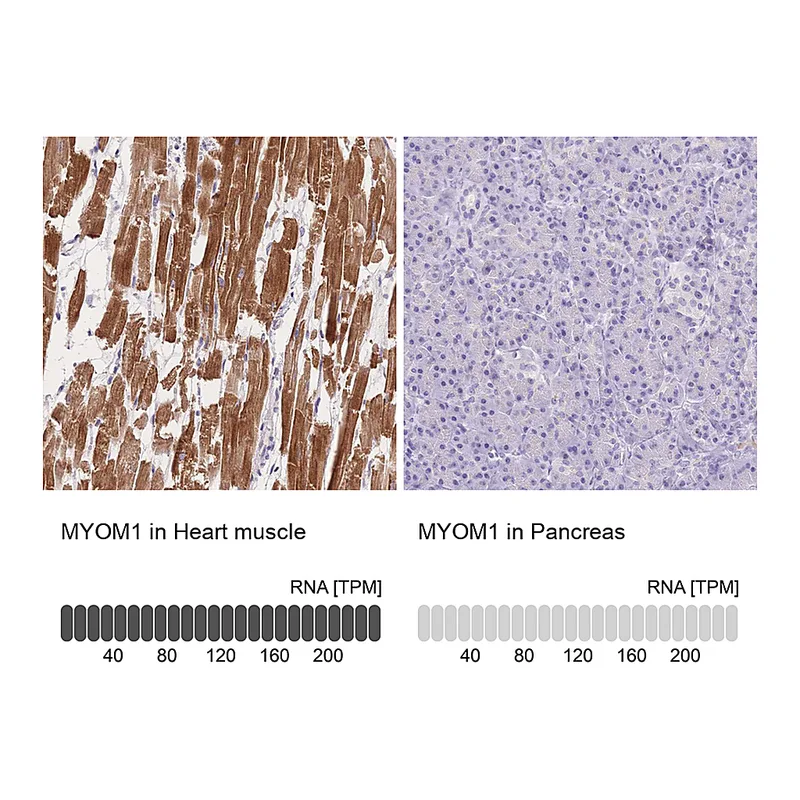 Atlas Antibodies Anti-MYOM1 Antibody