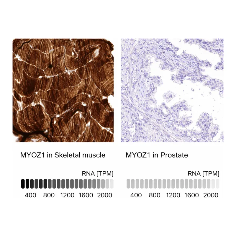 Atlas Antibodies Anti-MYOZ1 Antibody