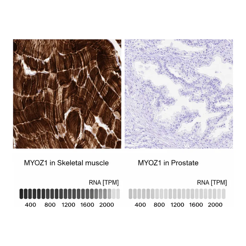 Atlas Antibodies Anti-MYOZ1 Antibody