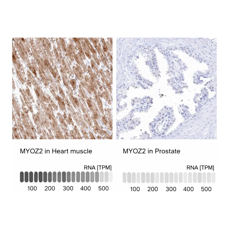 Atlas Antibodies Anti-MYOZ2 Antibody
