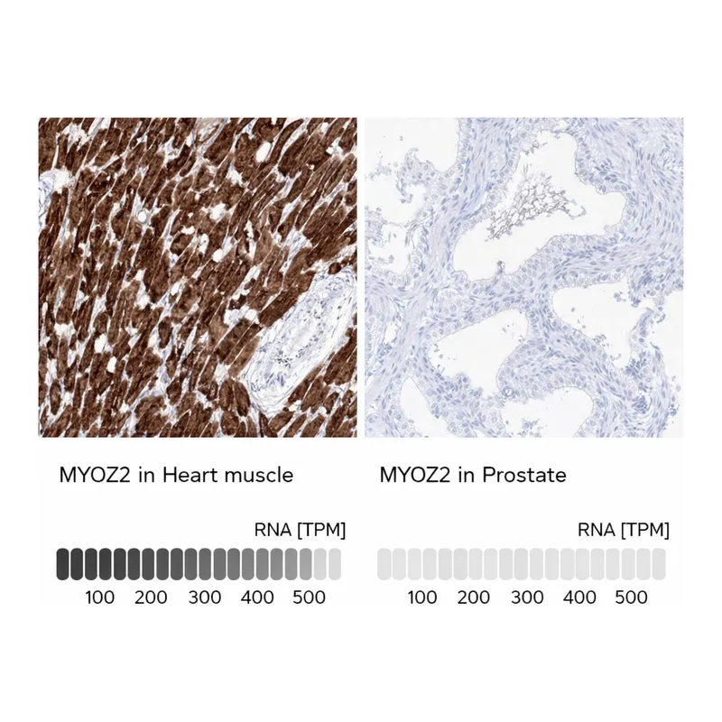 Atlas Antibodies Anti-MYOZ2 Antibody