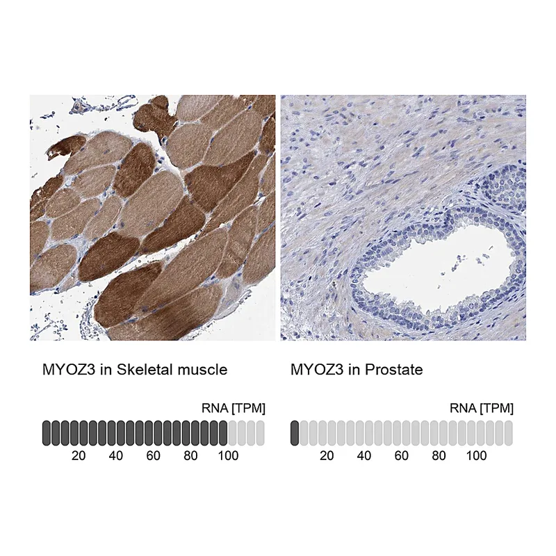 Atlas Antibodies Anti-MYOZ3 Antibody