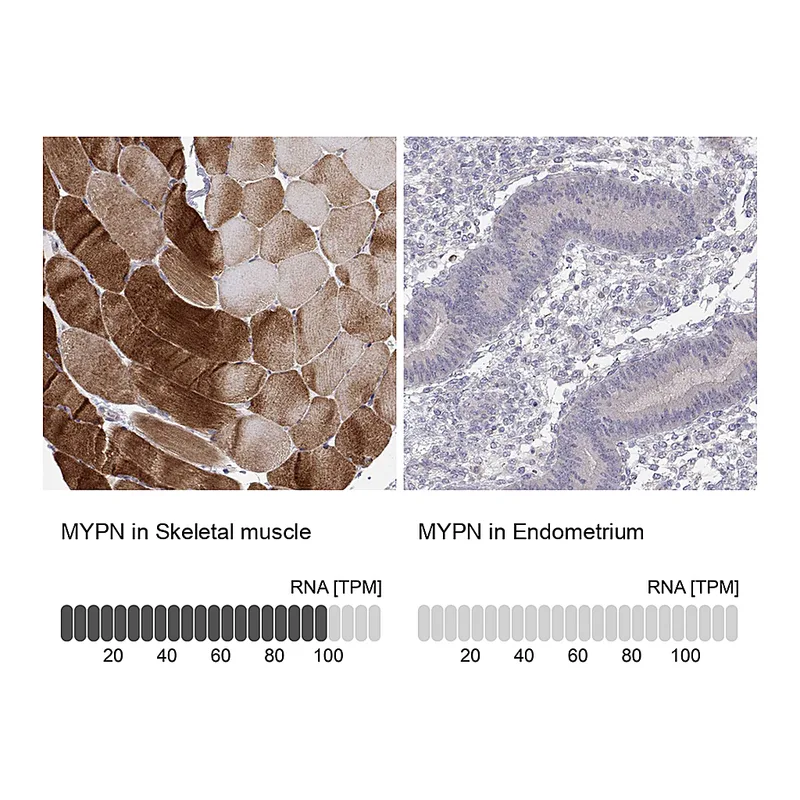 Atlas Antibodies Anti-MYPN Antibody