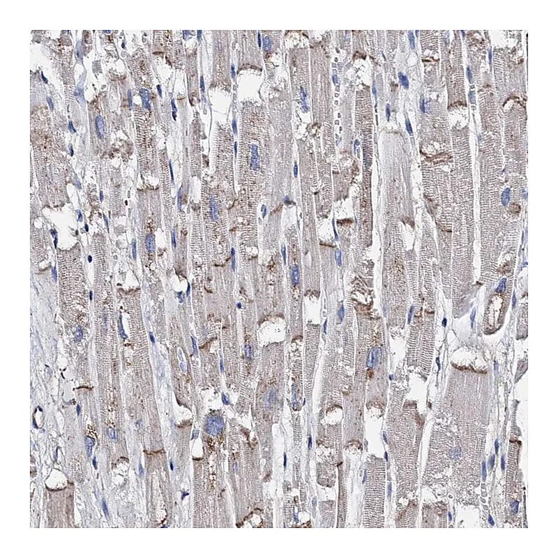 Atlas Antibodies Anti-MYZAP Antibody