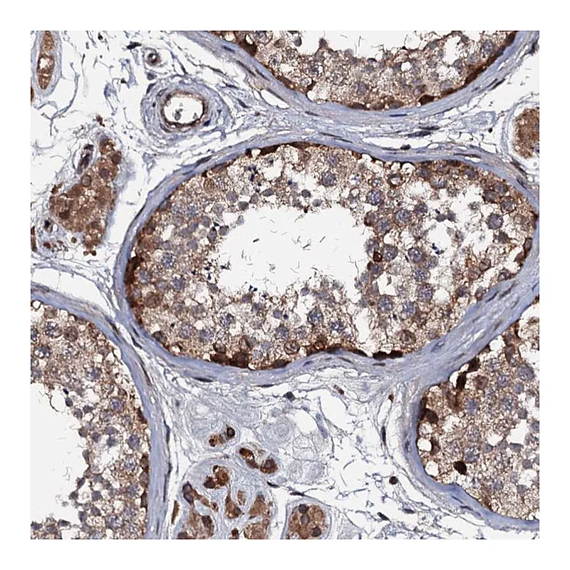 Atlas Antibodies Anti-N4BP1 Antibody