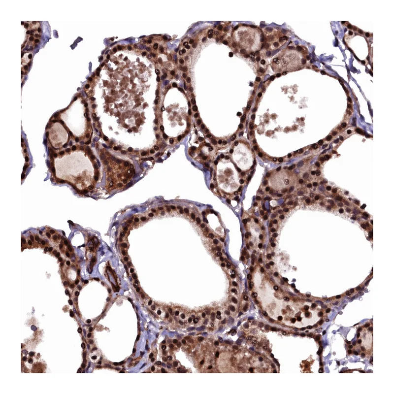 Atlas Antibodies Anti-N4BP1 Antibody