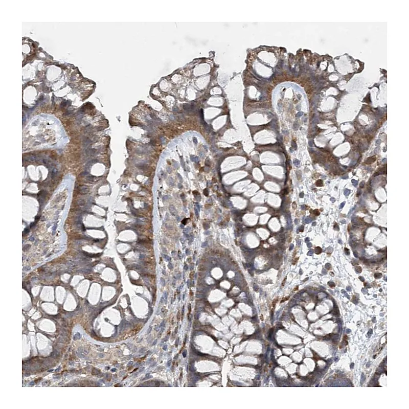 Atlas Antibodies Anti-N4BP2 Antibody