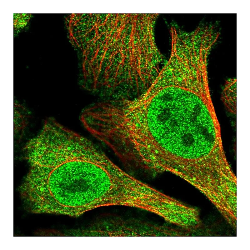 Atlas Antibodies Anti-N4BP2 Antibody