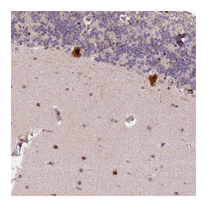 Atlas Antibodies Anti-N4BP2L1 Antibody