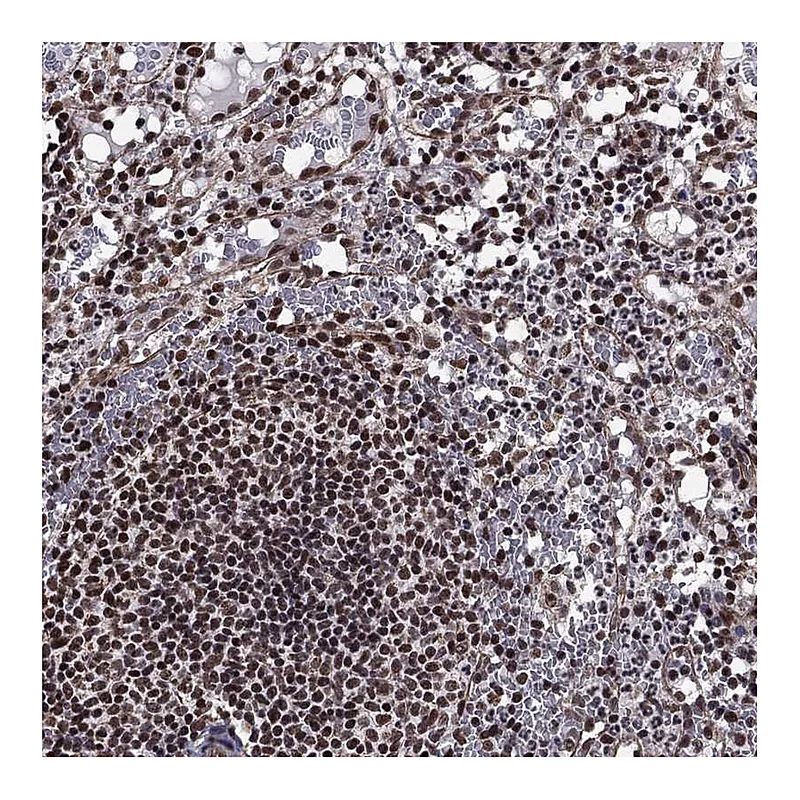 Atlas Antibodies Anti-N4BP2 Antibody