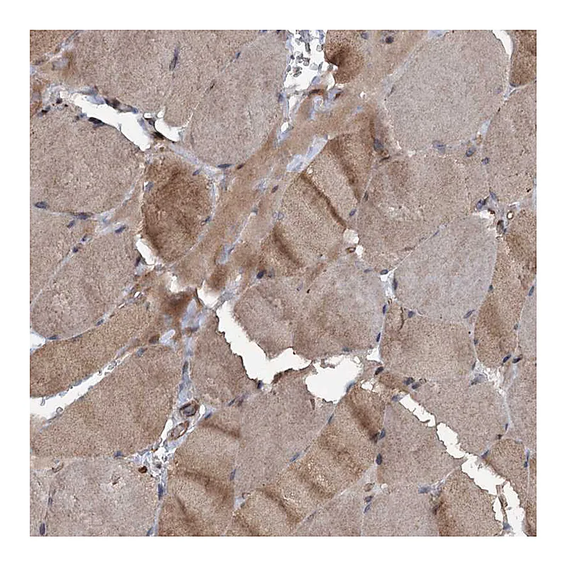 Atlas Antibodies Anti-N4BP2L2 Antibody