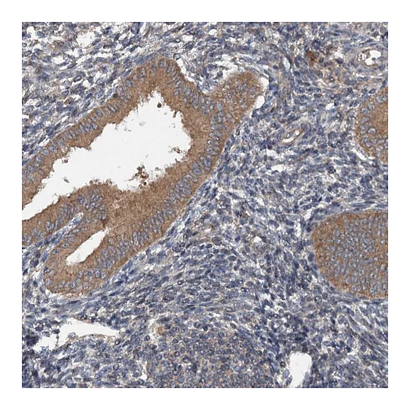 Atlas Antibodies Anti-N4BP2L2 Antibody