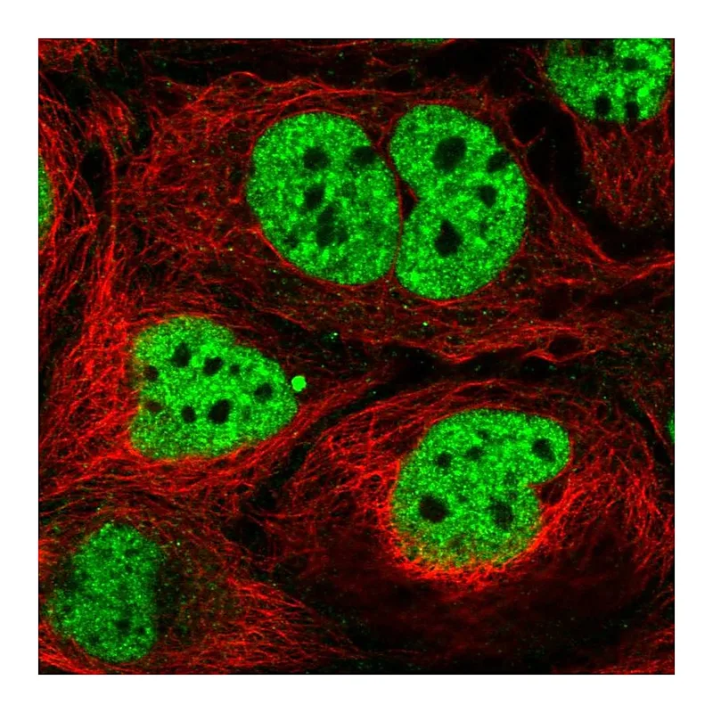Atlas Antibodies Anti-N4BP2L2 Antibody