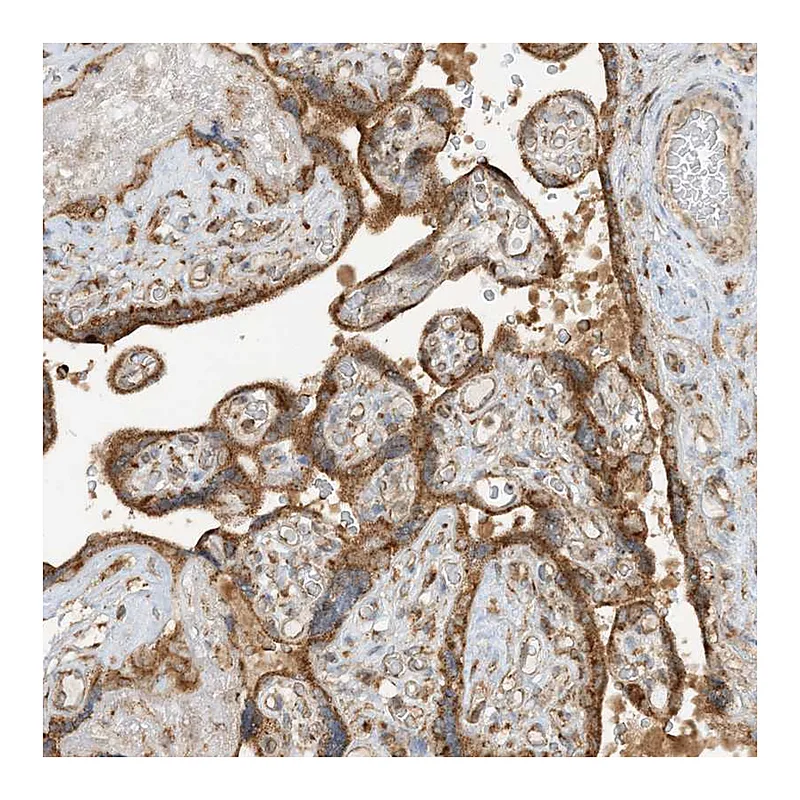 Atlas Antibodies Anti-N4BP3 Antibody